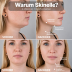 Skinelle EMS Pro